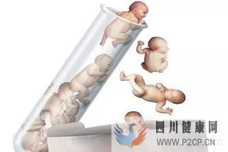 試管嬰兒的一個(gè)基本流程和周期時(shí)間(二代試管嬰兒需要多長時(shí)間)(圖8) 試管嬰兒的一個(gè)基本流程和周期時(shí)間(二代試管嬰兒需要多長時(shí)間)(圖8)