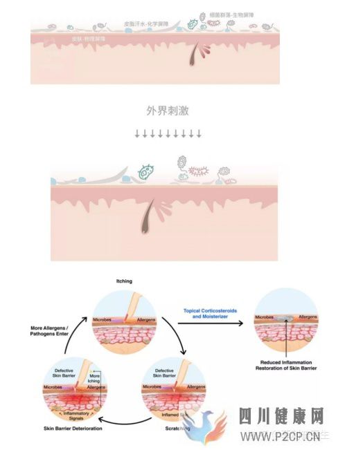 皮膚過敏,從原因到解決方案(圖10) 皮膚過敏,從原因到解決方案(圖10)