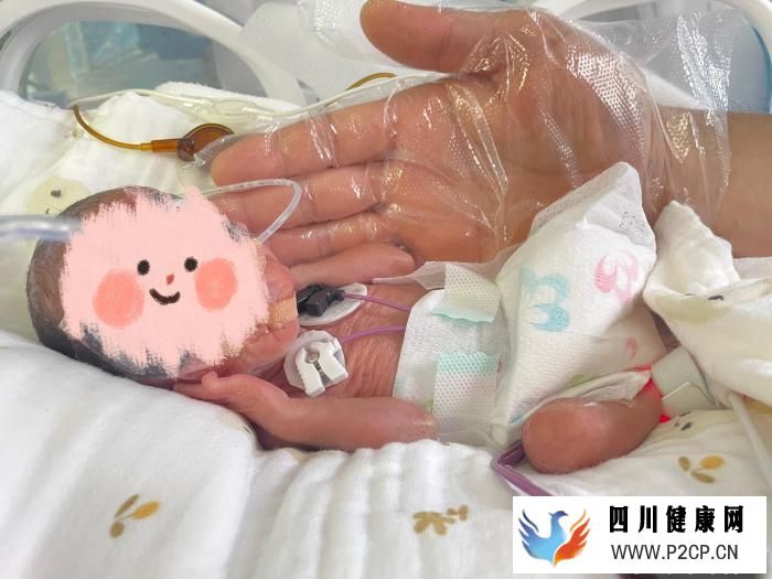 安徽600余克低體重試管雙胞胎闖過(guò)“呼吸關(guān)”(圖1) 安徽600余克低體重試管雙胞胎闖過(guò)“呼吸關(guān)”(圖1)